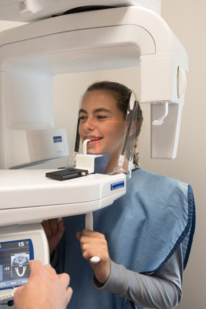 digital-oral-xray-machiene