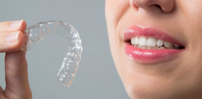 Invisalign Aligner